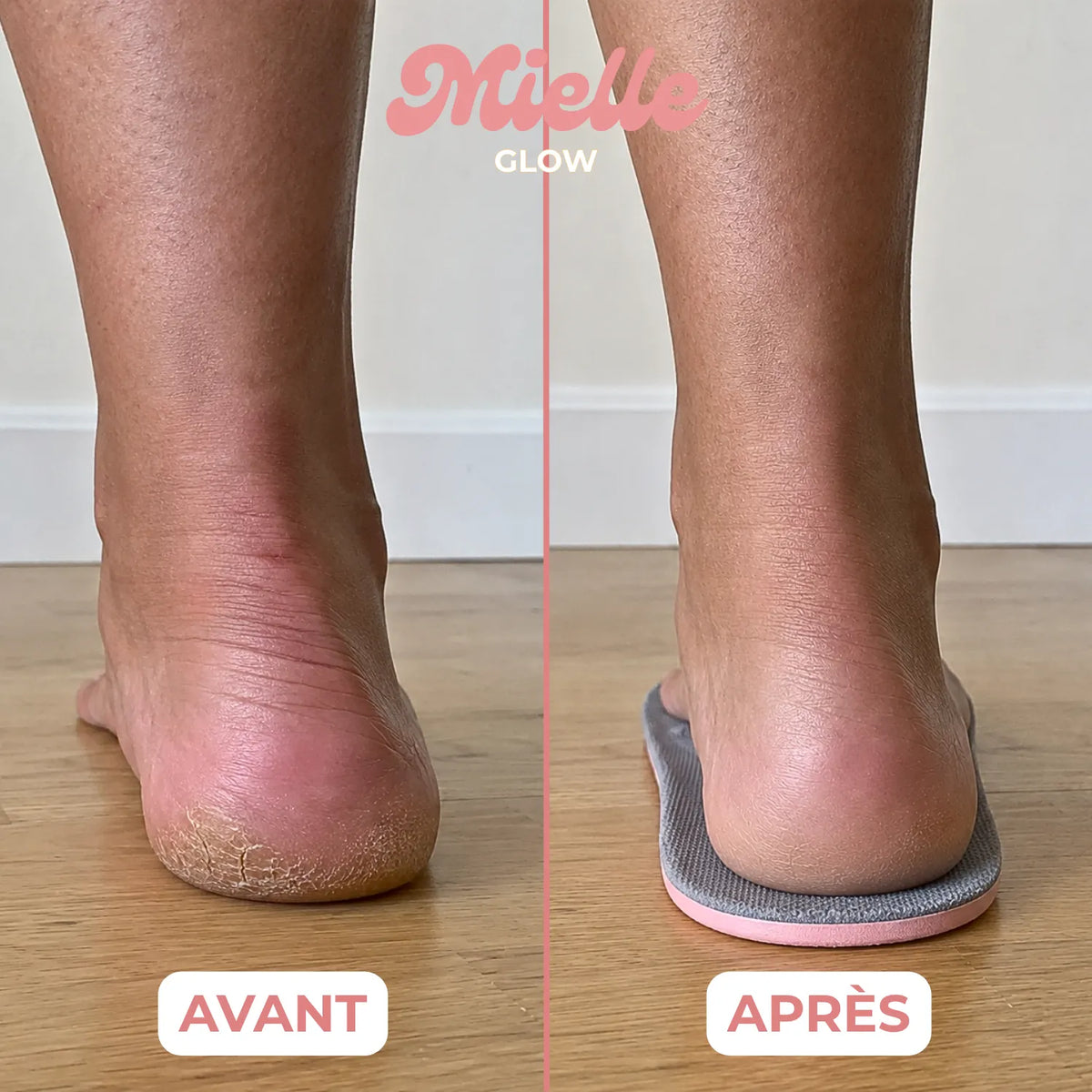 ☁️ SoftStep™ – Semelles Orthopédiques