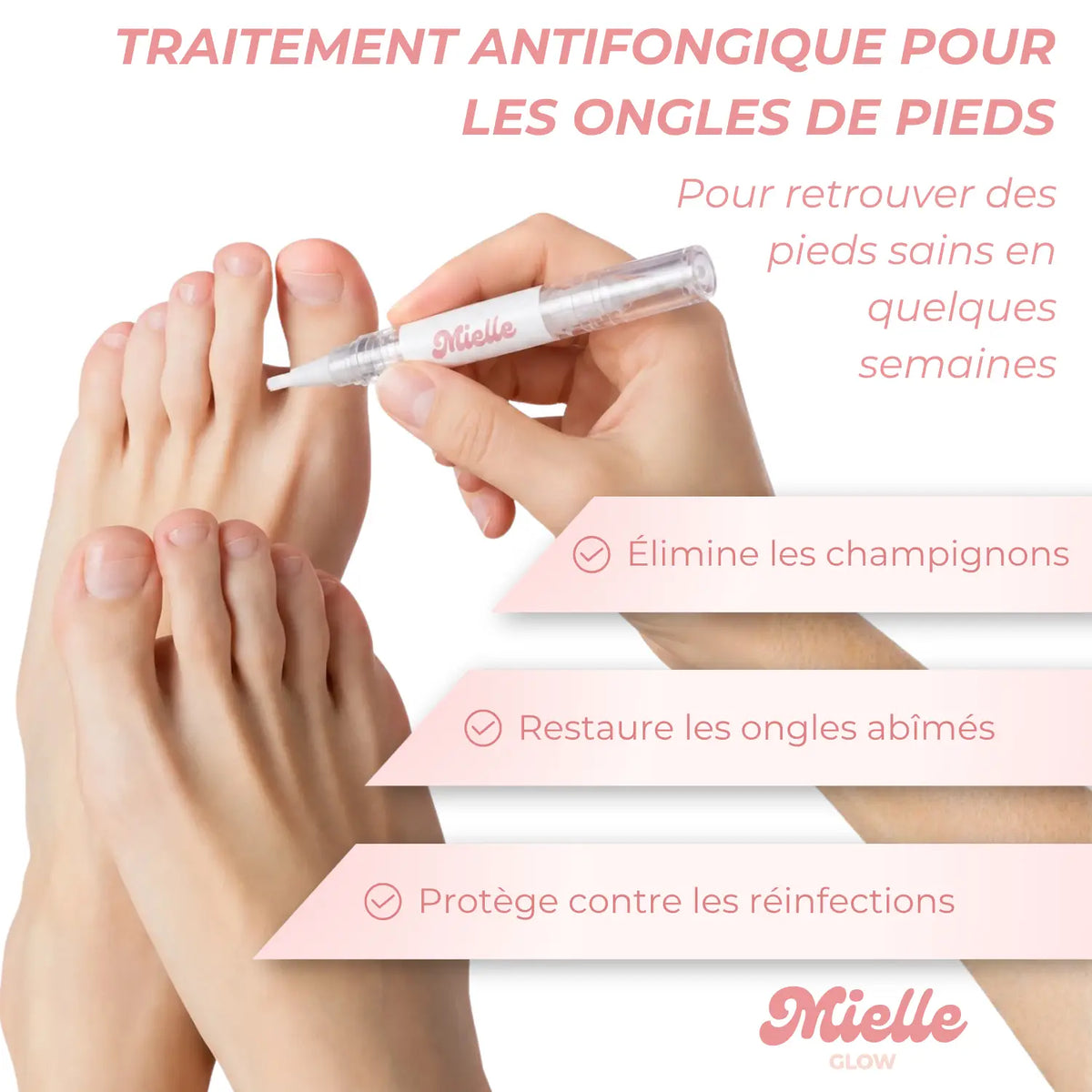 🪄 Stylo réparateur ongles de pieds - Traitement antifongique