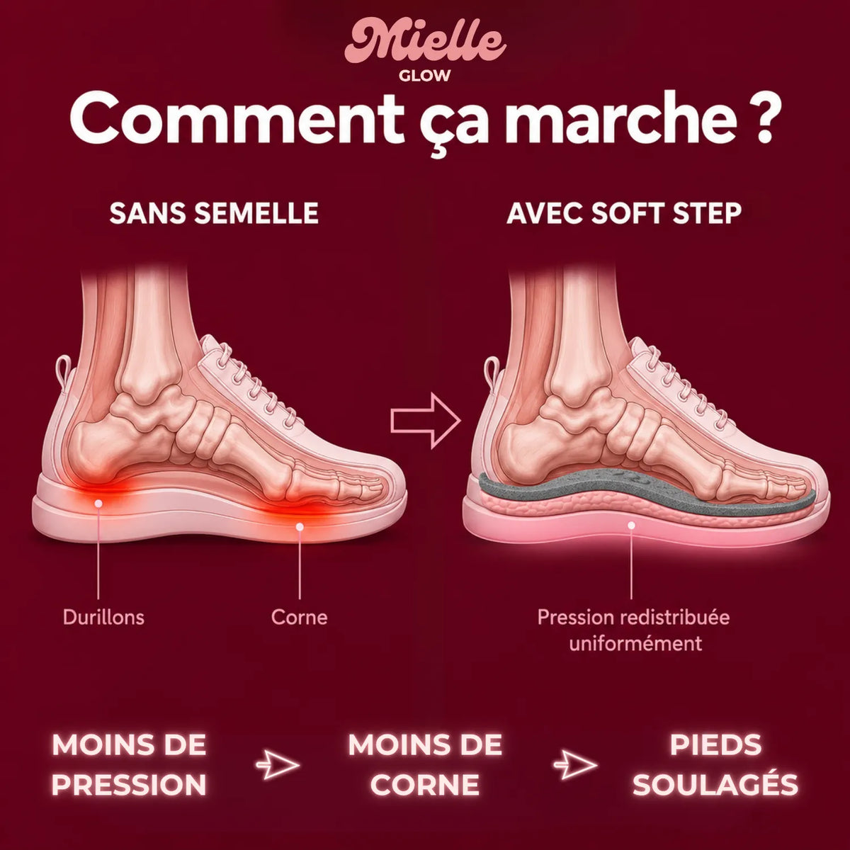 ☁️ SoftStep™ – Semelles Orthopédiques