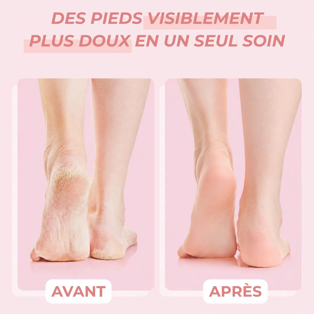 🩰 Peeling Masque chaussette exfoliant
